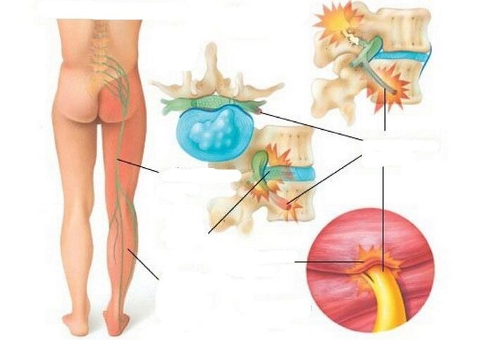 Types and causes of pain
