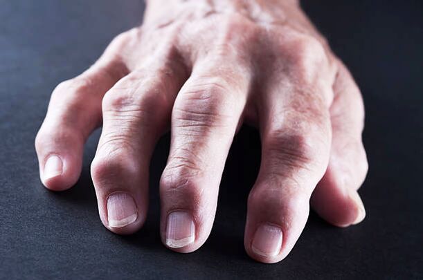 pain in the joints of the fingers