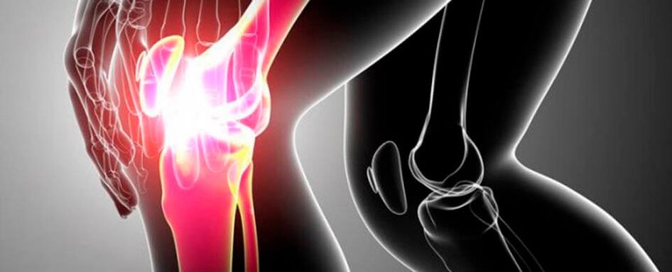 pain in the knee joint photo 4