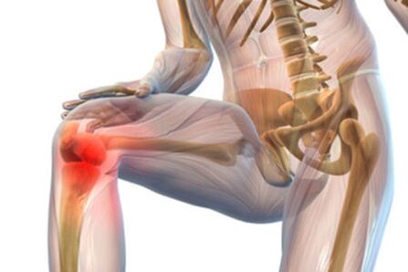 Pain in the knee joint with arthrosis
