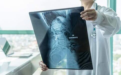 X-ray is a necessary diagnostic method if the back hurts
