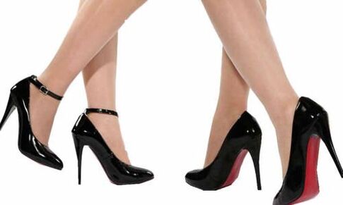 The cause of cervical osteochondrosis in women can be an addiction to high heels